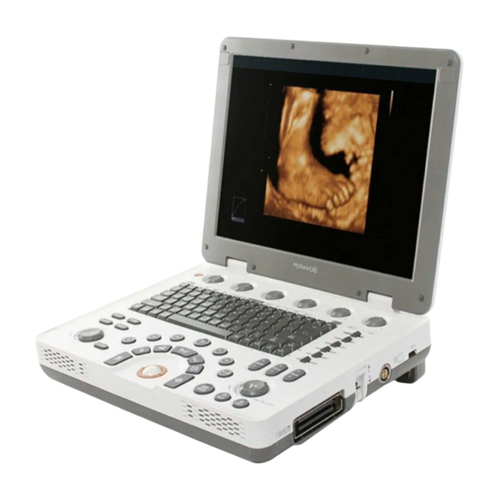 УЗИ аппарат Samsung MySono U6