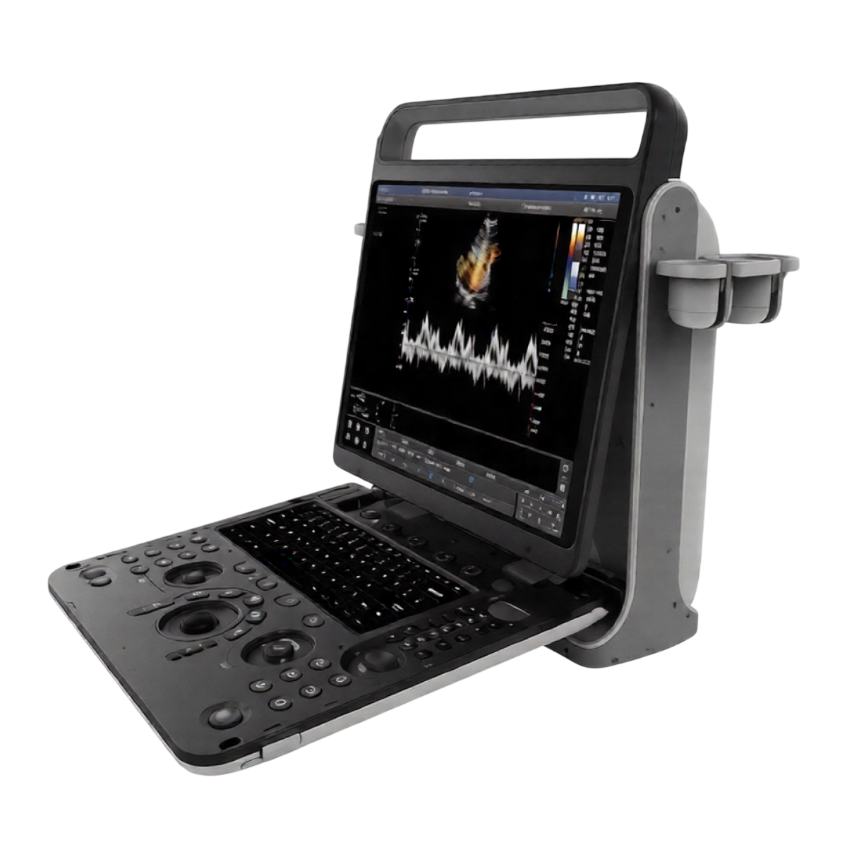 Портативный УЗИ аппарат Chison SonoTouch 60 Pro