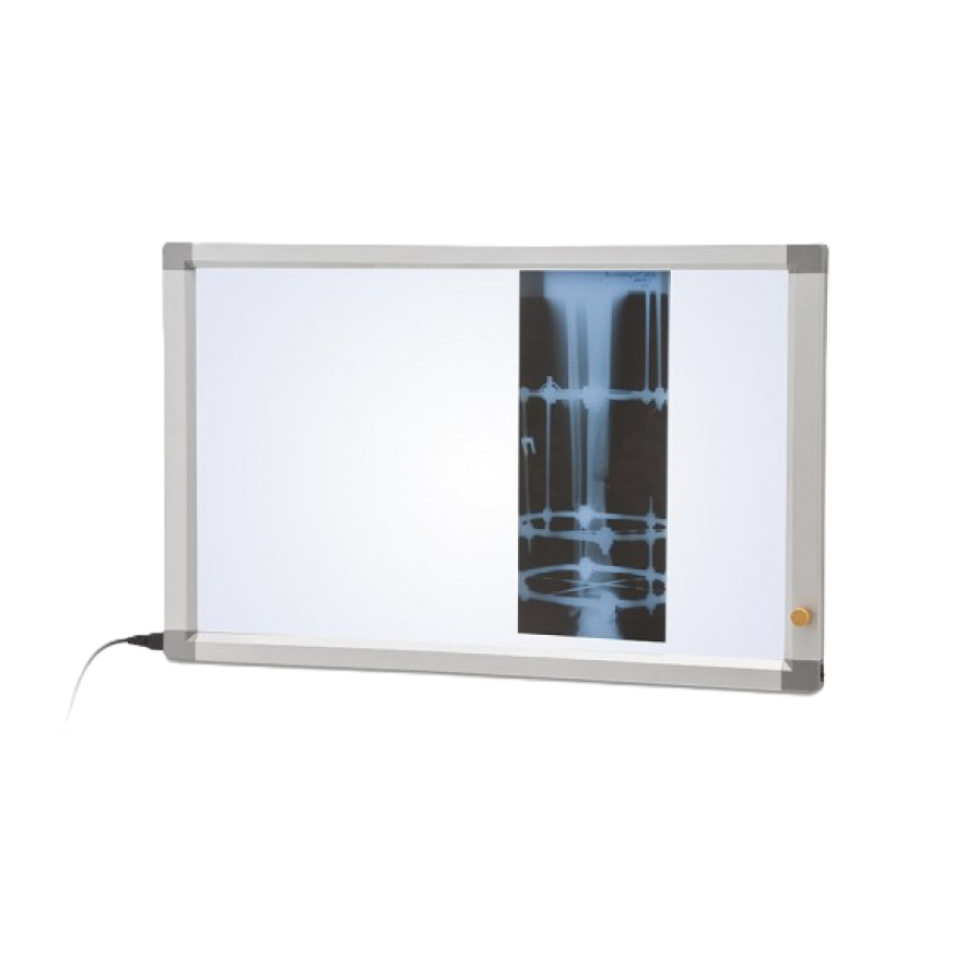 Негатоскоп общего назначения Армед 2-х кадровый