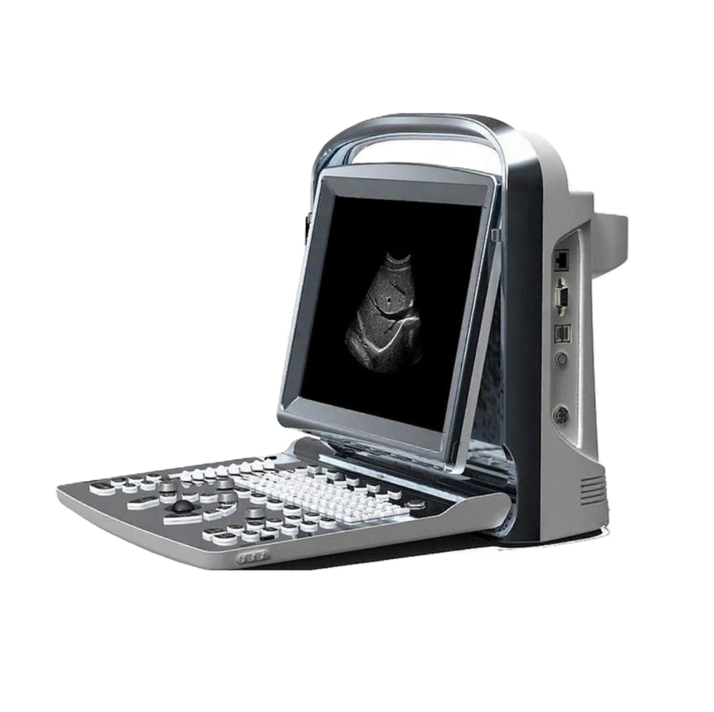 Портативный УЗИ аппарат Chison SonoTouch 10