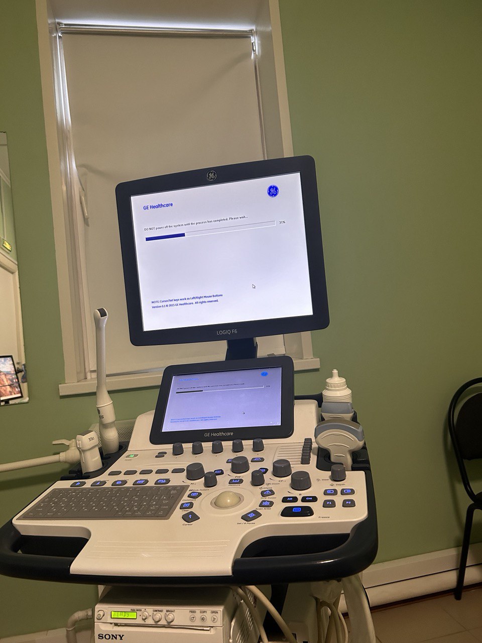 Ремонт GE Logiq F6: устранение ошибки базы данных и программного сбоя