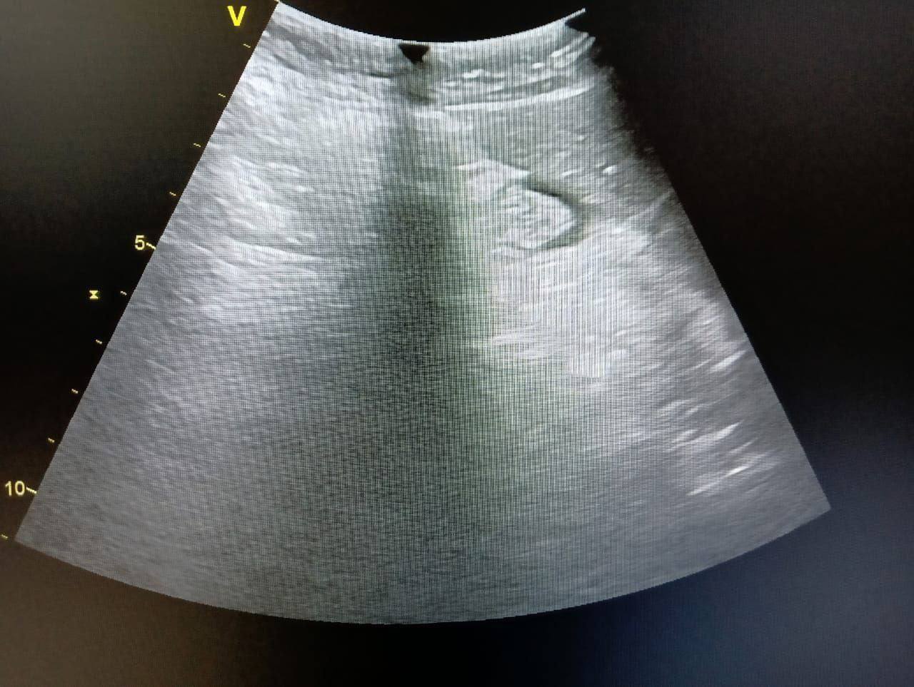 Ремонт Vivid T8: устранение деградации изображения при исправной системе