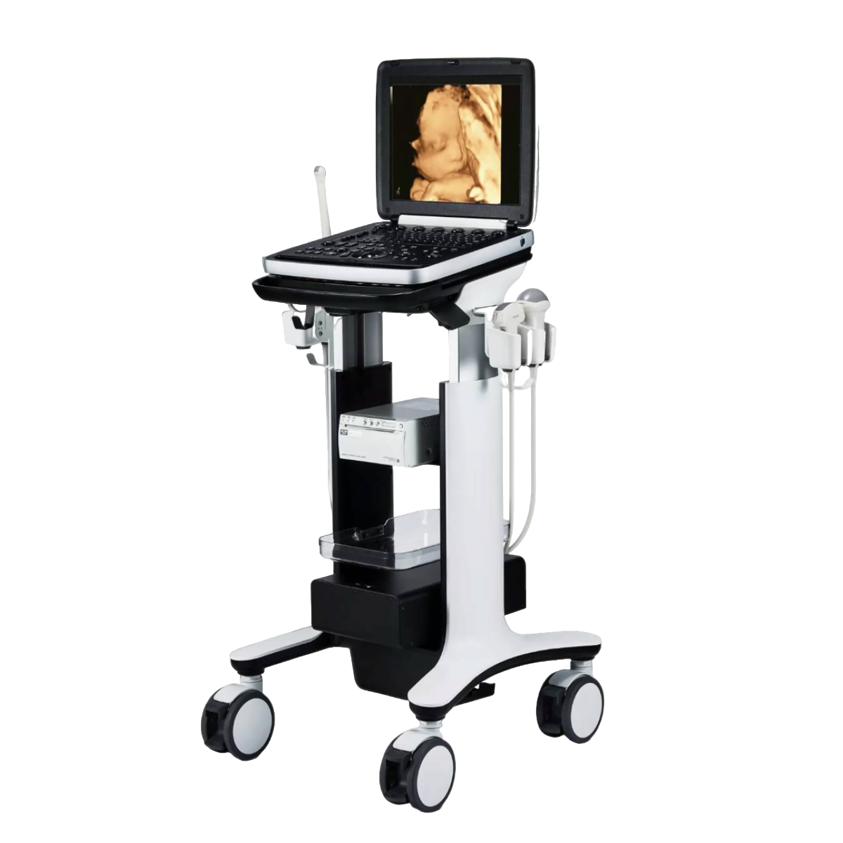 УЗИ аппарат РуСкан 70П