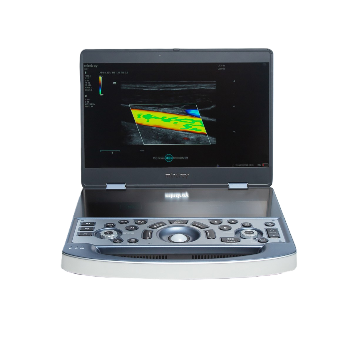 УЗИ аппарат Mindray MX7
