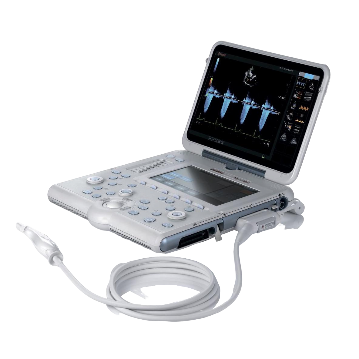 УЗИ аппарат Esaote MyLab Alpha