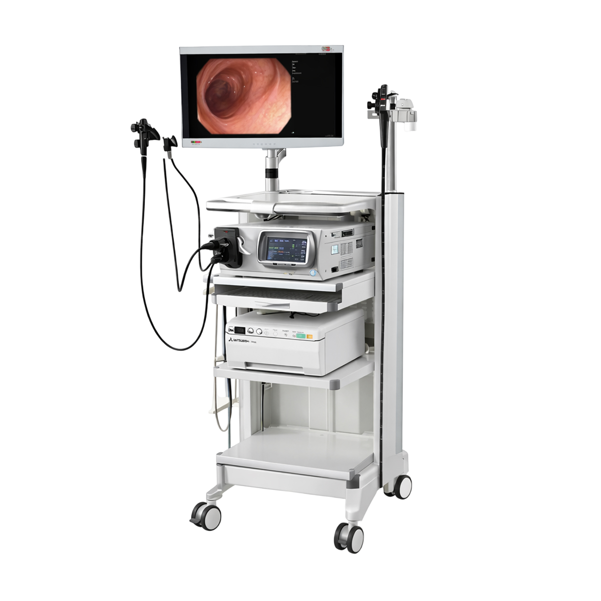 Видеоэндоскопическая система на базе Pentax EPK i7010 OPTIVISTA Plus