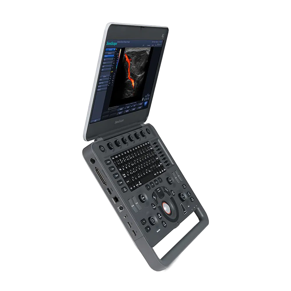 Ультразвуковой аппарат SonoScape S2N Vet