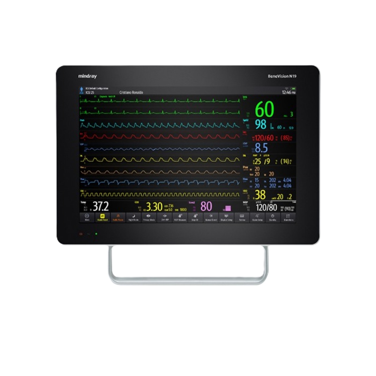 Монитор пациента Mindray BeneVision N19