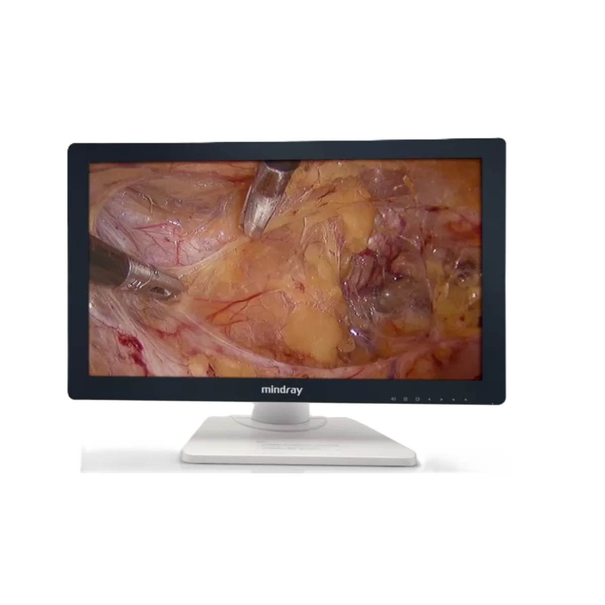 Эндоскопическая видеосистема Mindray HD3