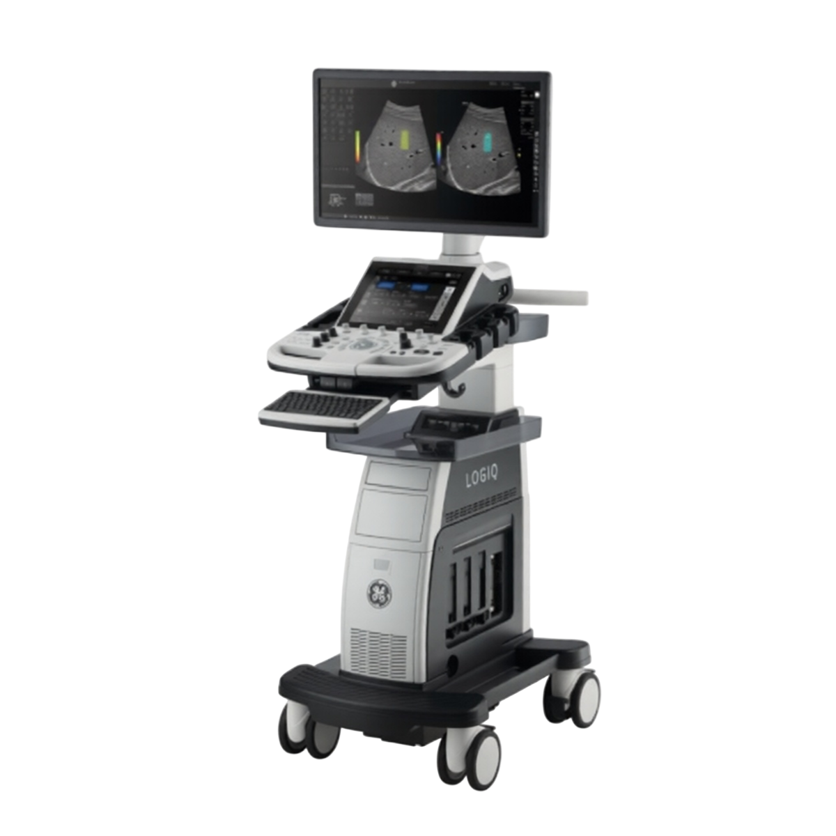 Ультразвуковая диагностическая система GE LOGIQ P10