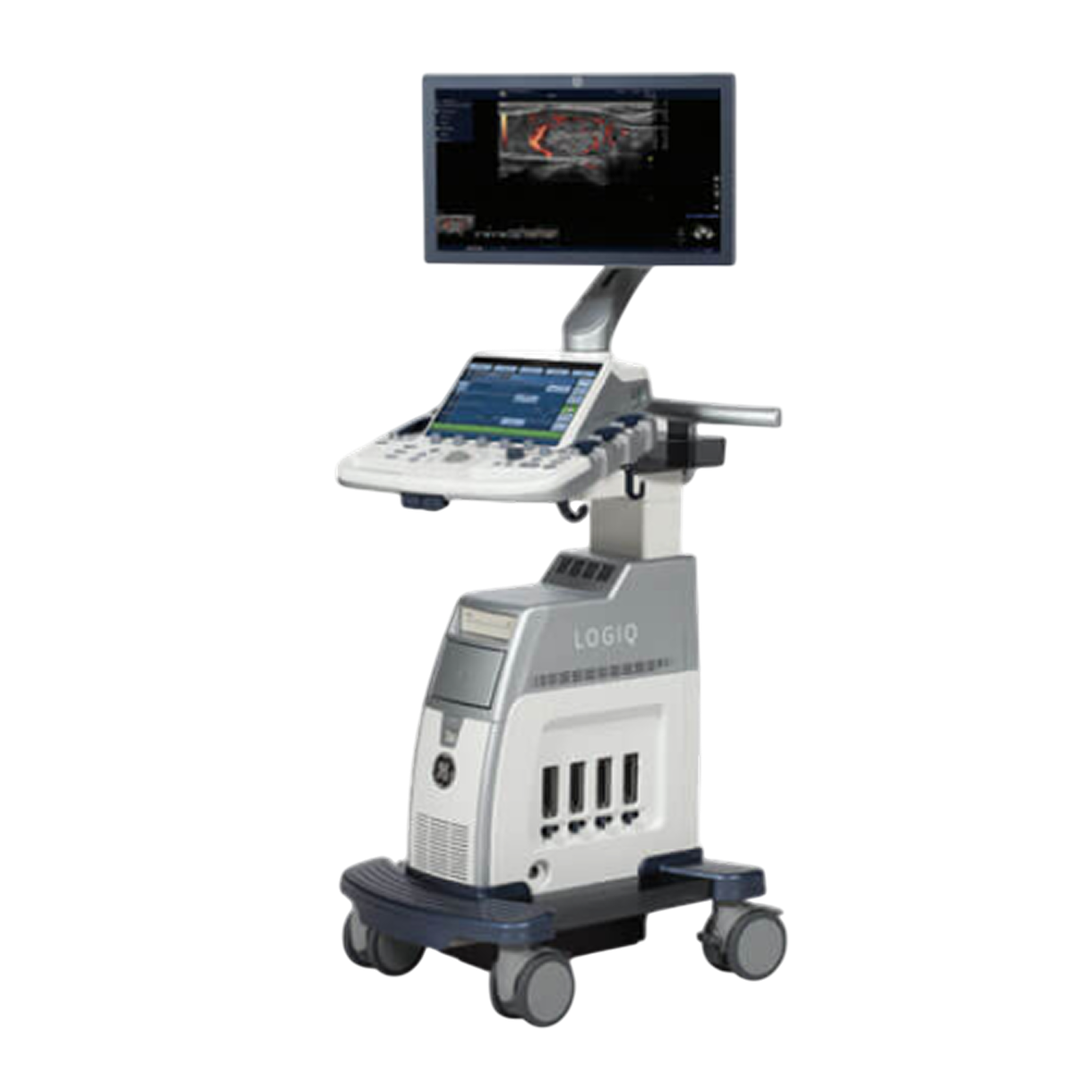 Ультразвуковая диагностическая система GE LOGIQ P9