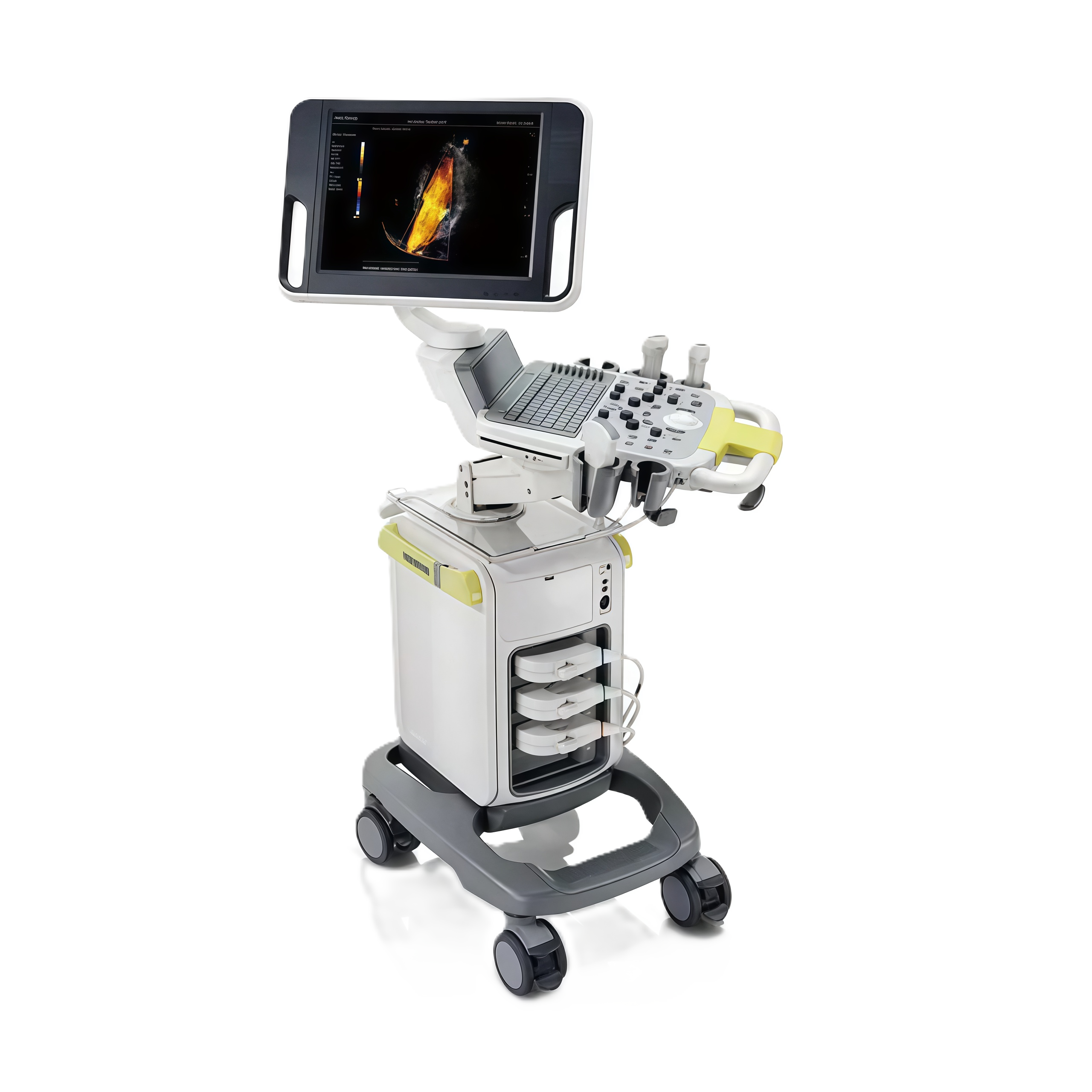 УЗИ аппарат Mindray DC-N3