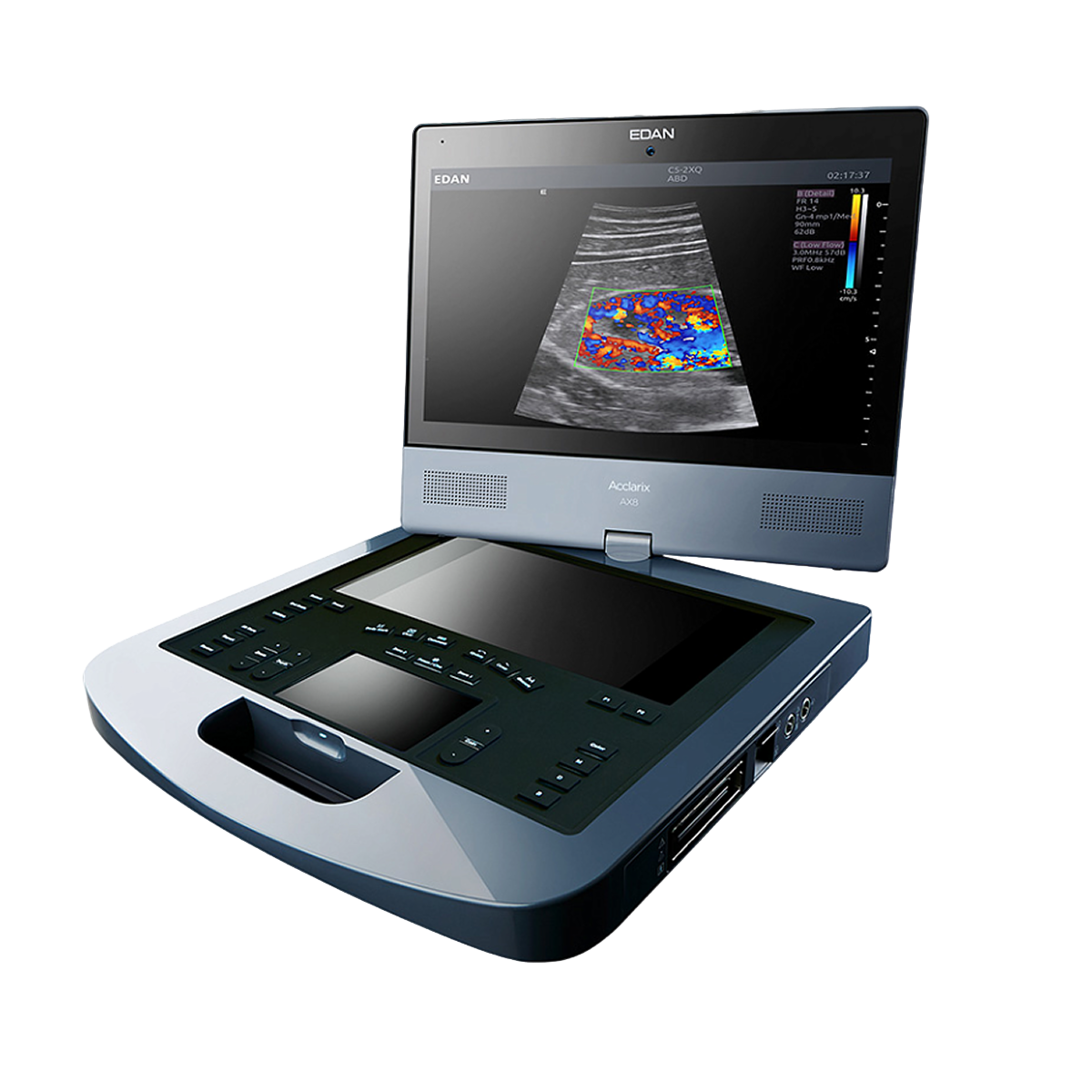 Аппарат УЗИ Edan Acclarix AX8