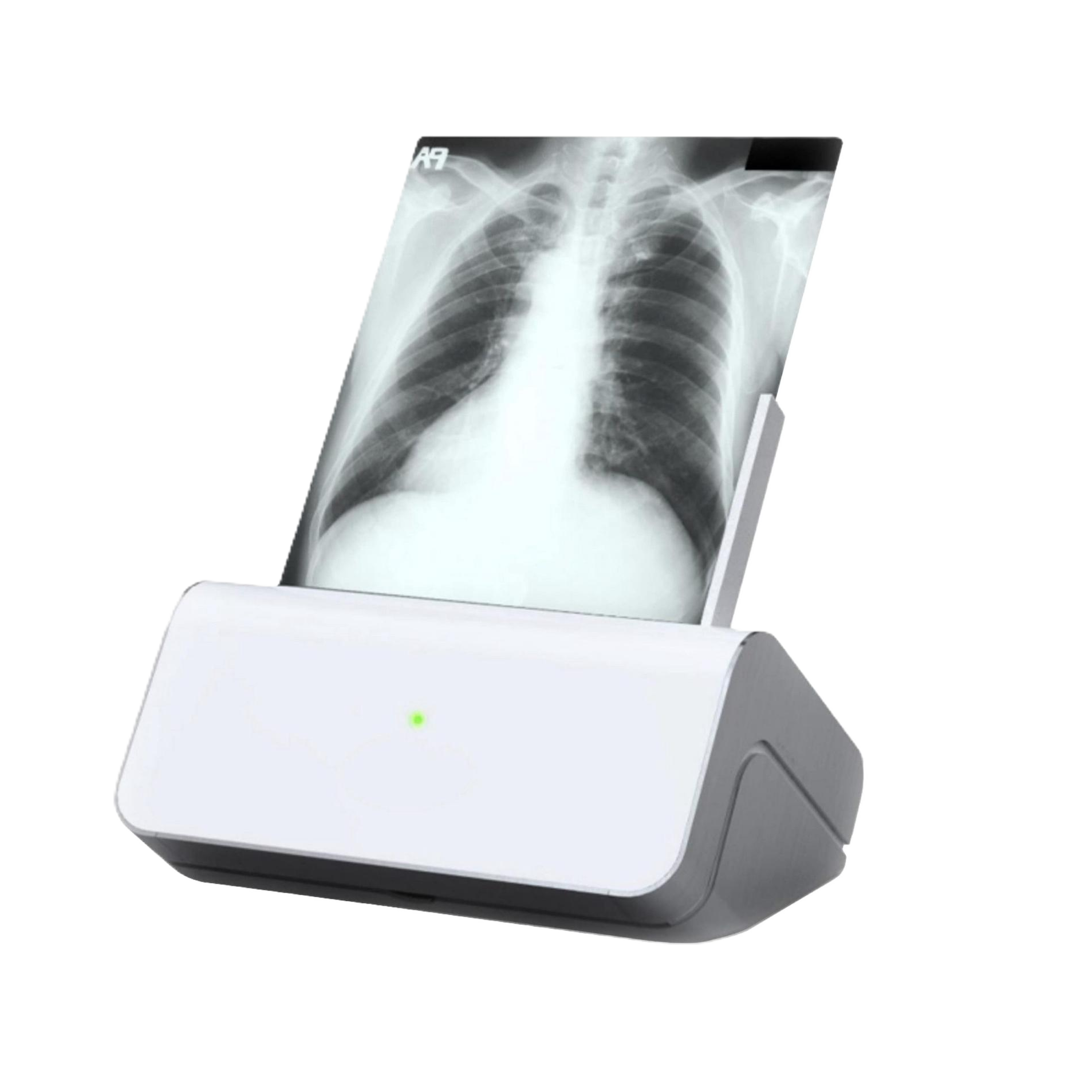 Оцифровщик-сканер рентгеновских пленок Rayscan Plus