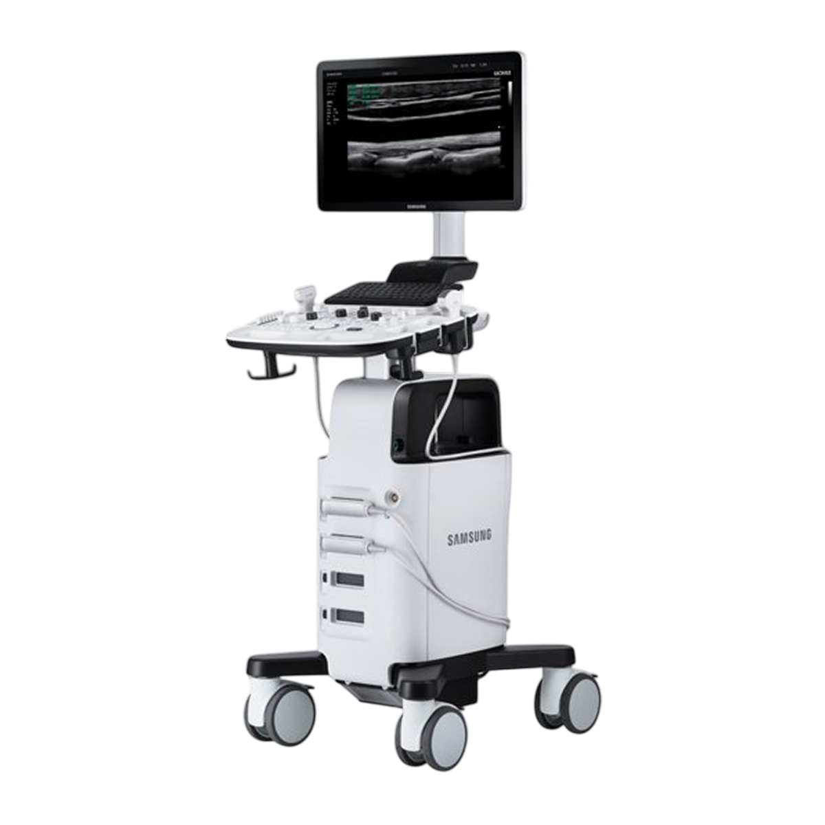 УЗИ аппарат Samsung HS30