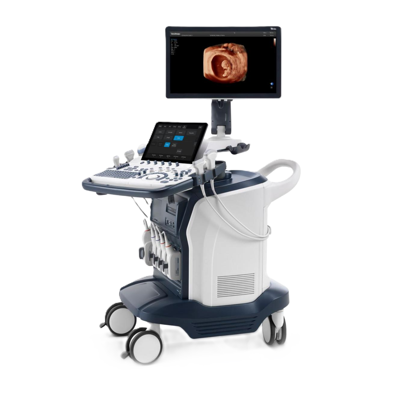 Ультразвуковой аппарат SonoScape S60 Exp