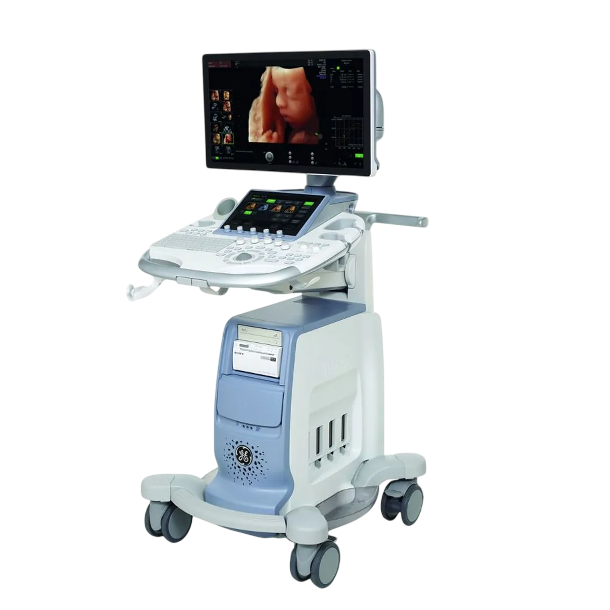 Ультразвуковая диагностическая система GE Healthcare Voluson E10