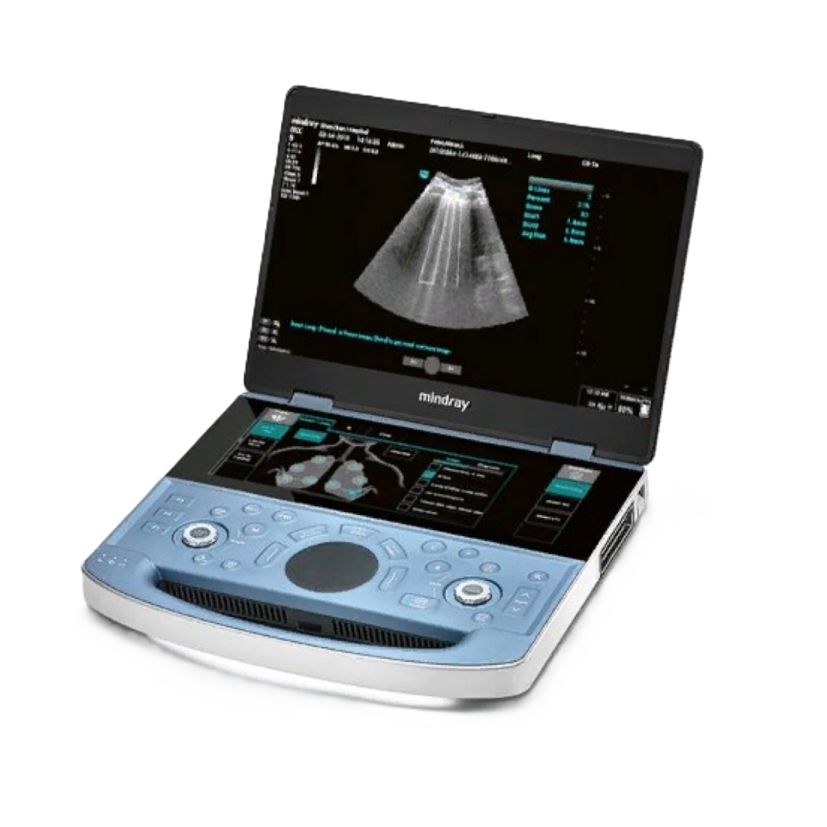 Ультразвуковой аппарат Mindray ME7 Exp