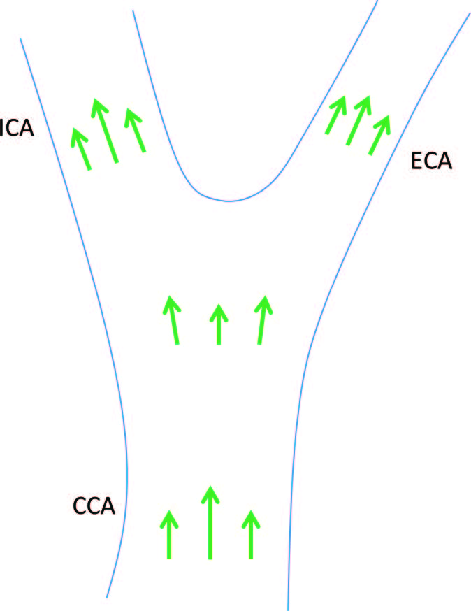 vflow_4_1.jpg vflow_4_1.jpg