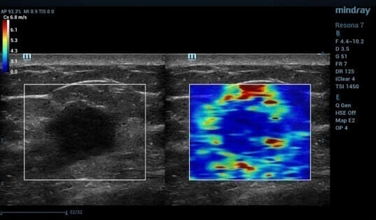 unnamed-9-e1620510946381.jpg unnamed-9-e1620510946381.jpg