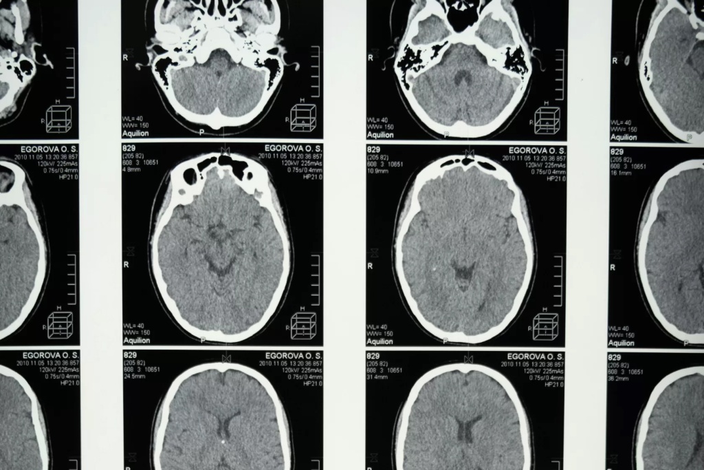 1 МРТ 2.jpg 1 МРТ 2.jpg