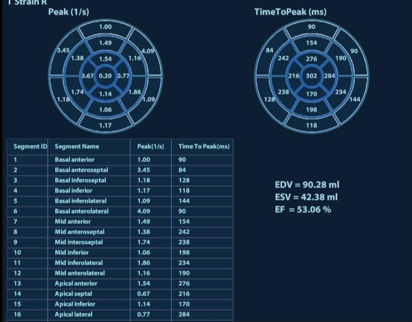 bullseye.png bullseye.png