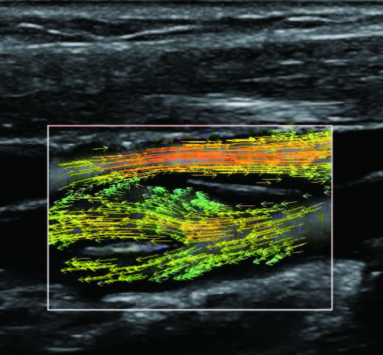 vflow_6_2.jpg vflow_6_2.jpg